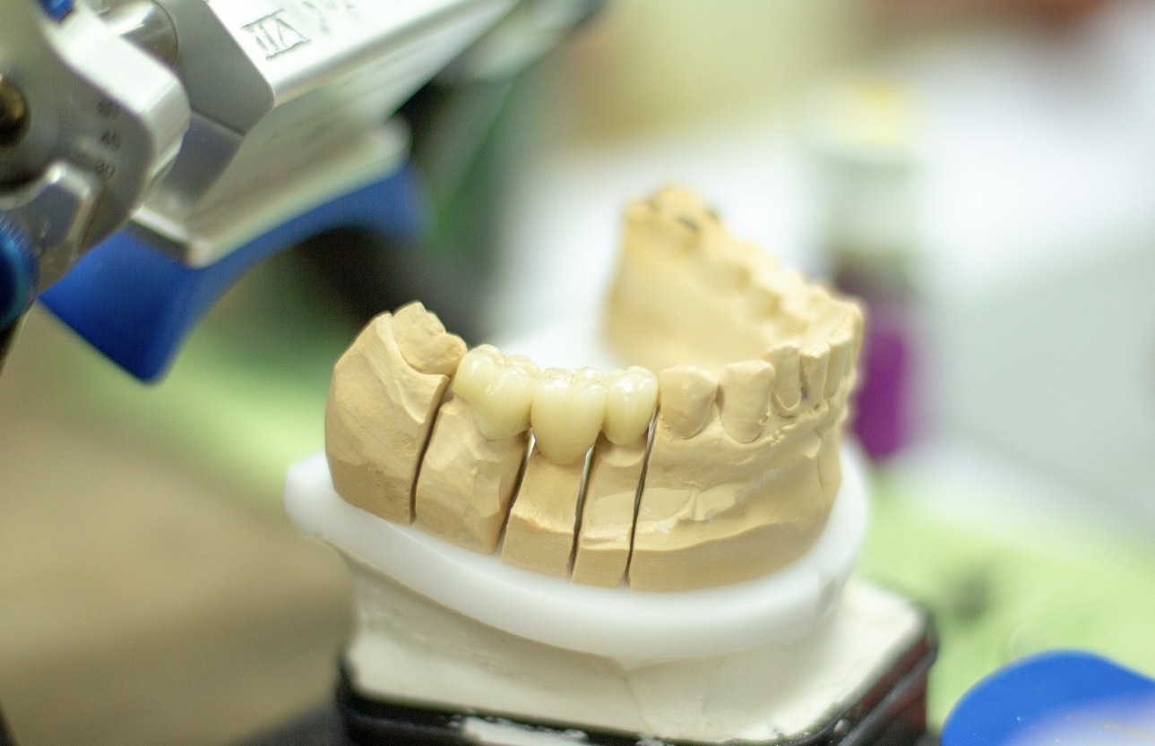 Prosthesis