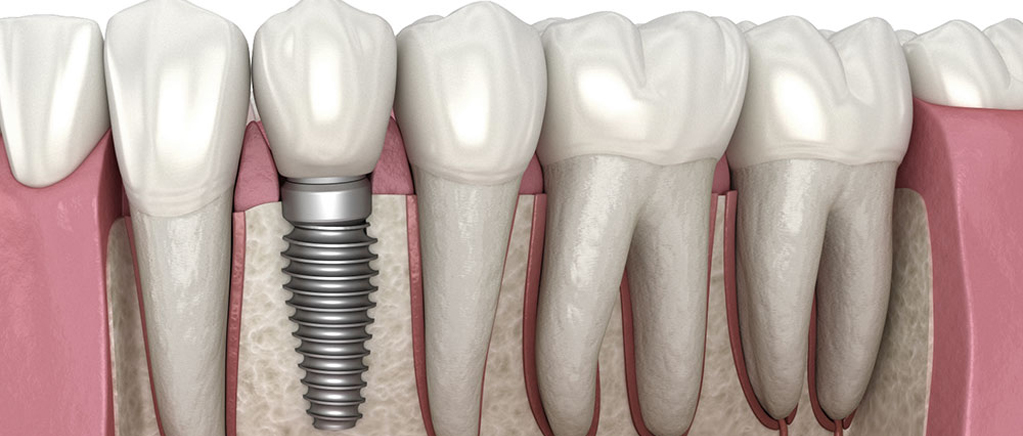 Bazı şeyler ertelenmez! 